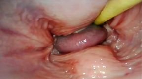 Orgasmo 